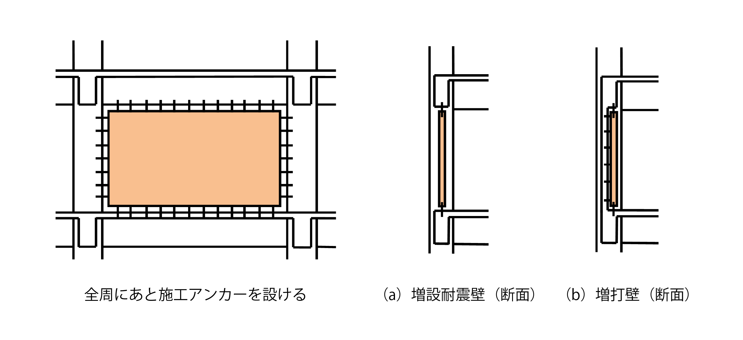 RC診断